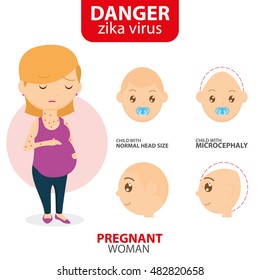 Zika symptom graphic design, Vector illustration