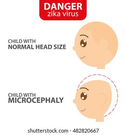 Zika symptom graphic design, Vector illustration