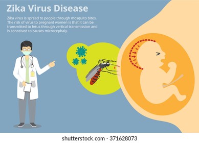 Zika virus infographic, background, and explanation. The Virus can be transmitted from a pregnant mother to fetus through vertical transmission.