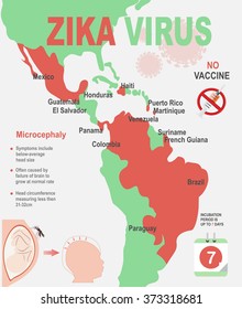 Zika virus infographic elements - prevention, transmission, vaccine, symptoms, microcephaly, protection measures. Zika virus disease. Zika virus design template. Isolated vector illustration.