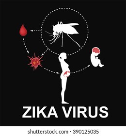 Zika virus infographic, vector. Pregnant woman with baby
