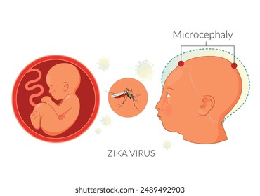 Zika Virus risk during Pregnancy  - Stock Illustration as EPS 10 File