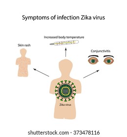 Zika Virus Symptoms Infection Infographics Vector Stock Vector (Royalty ...