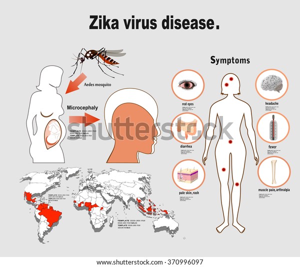 Zika Virus Symptoms Infographics Figures Text Stock Vector (Royalty ...