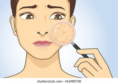 Zoom In Facial With Magnifier For Looking Dry Skin Problem Of Woman.