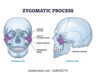 Zygomatic process as human cheek bone skeleton anatomy outline diagram. Labeled educational cheekbone location and skull parts structure vector illustration. Frontal, orbital and temporal process.