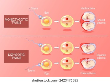 Desarrollo de zygota en mellizos monozgóticos y dizgóticos. Desde la fertilización, el huevo más esperma hasta la formación de sacos amnióticos. Vector isométrico. Ilustración plana