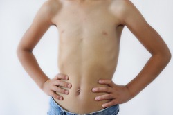 A thin child posing without a shirt. 