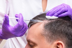 Injection, Treatment for Hair Loss