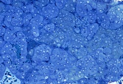 Adrenal medulla. Thick cords mof light adrenaline cells, among which are darker and scarcer noradrenaline cells.  0.5 µm thick semithin section of plastic-embedded material. Toluidine blue.