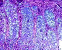 Adrenal cortex. Zona glomerulosa. It is formed by elongated cells that are arranged to form elongated ovoid nests. These cells have lipid droplets as is typical of steroid-secreting cells. 