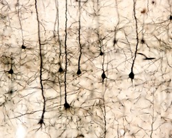 Pyramidal neurons of the cerebral cortex impregnated with the Golgi method.