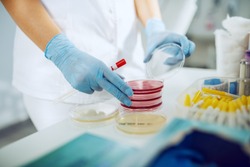 Close up of caucasian female lab assistant with sterile rubber gloves opening petri dish and holding cotton swab in hand.