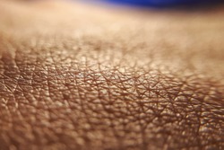 Skin cancer concept. Close up human skin. Macro epidermis texture. Pores and folds of human skin. Dry skin.