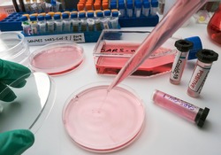 Scientist working on sars-cov-2 coronavirus covid-19 on a petri dish in the laboratory, conceptual image