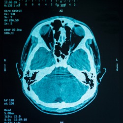  film X-ray scanner of head  background.