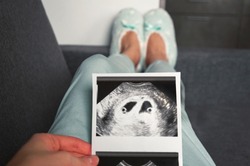 The girl is holding a snapshot of an ultrasound twin in the fourth week of pregnancy. First trimester. Selective focus