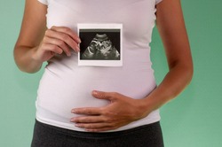 The girl is holding a snapshot of an ultrasound twin in the fourth week of pregnancy. First trimester. Confirmation of pregnancy