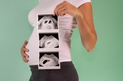 The girl is holding a snapshot of an ultrasound twin in the fourth week of pregnancy. First trimester. Confirmation of pregnancy
