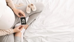 Pregnant woman enjoying future motherhood with first ultrasound photo of her baby, top view with free space