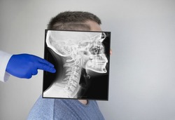 Survey radiography of a man’s skull on the side. A doctor radiologist is studying an x-ray examination. A snapshot of the skull is placed on the patient’s head.