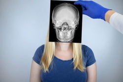 Survey radiography of the skull of a woman. A doctor radiologist is studying an x-ray examination. A snapshot of the skull is placed on the patient’s head.