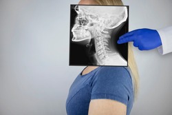 Survey radiography of a woman’s skull and neck on the side. A doctor radiologist is studying an x-ray examination. A snapshot of the skull is placed on the patient’s head.