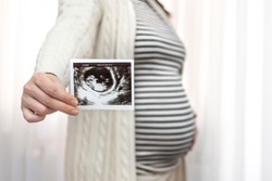 Cropped image of young pregnant woman holding ultrasound picture on belly. Concept of pregnancy, health care, gynecology, medicine. Mother waiting baby. Close-up. Black and white pregnancy photo.