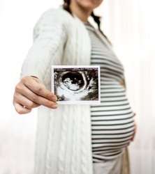 Vertical cropped image of young pregnant woman holding ultrasound picture on belly. Concept of pregnancy, health care, gynecology. Mother waiting baby. Close-up. Black and white pregnancy photo.