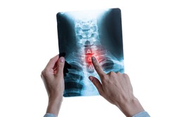 X-ray image of vertebral column with red pain point in cervical spine in hands of specialist