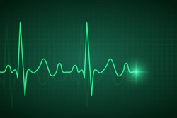 Pulse Trace - Free Stock Photo by Pixabay on Stockvault.net