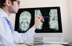Forensic radiologist doctor analyzing a nasal bone fracture x ray after.