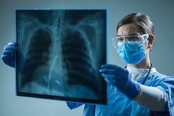 Female doctor in hospital holding patient x-ray film,radiologist studying radiography result,radiology specialist interpreting COVID-19 patient chest scan on asthma,lung disease or bone cancer illness