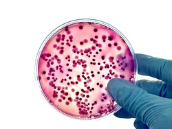Isolated dark red and pink colonies of mixed bacteria such as E. coli, Salmonella or Enterobacteriaceae that growing on red agar plate 