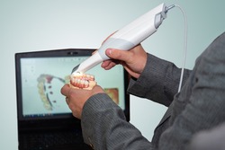 Dental intraoral scanner in hands of a man. Snapshot from a scaner is displayed on a laptop screen. Man takes a picture of his teeth using dental equipment. Demonstration of a dental intraoral scaner