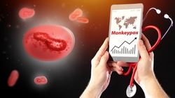 Monkeypox virus strain. Graph growth monkeypox infections in phone. Doctor hands with stethoscope on dark. Molecule is infected with fever. Monkeypox epidemic. Infectious virus outbreak. 
