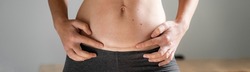 Woman abdomen with cesarean scar. Home candid lifestyle. C section surgery for pregnant woman. Recovering after birth. 