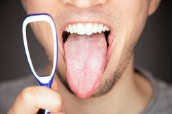 white covered and coated tongue out with tiny bumps is indicator for sickness and infections and reason for bad breath and smell but can be cleaned by tongue coating cleaner by scraping the white foam