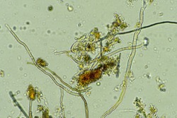 microorganisms and soil biology, with nematodes and fungi under the microscope.