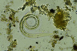 microorganisms and soil biology, with nematodes and fungi under the microscope. in a soil and compost sample