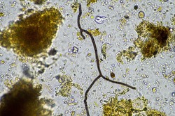 soil microbes organisms in a soil and compost sample, fungus and fungi and under the microscope in regenerative agriculture. in australia.
