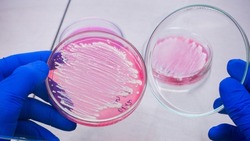 Scientist holds in his hand an open petri dish with bacteria on a pink background, close-up. Analysis of the growth of microorganisms on pigment agar.