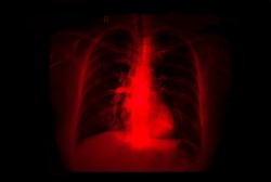 X-ray of adult female lungs, conditions after COVID-19, pandemic in Latin America, post-pandemic costs.