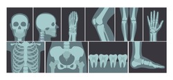 Vector illustration set of many X-rays shots of human body, X-ray pictures of head, hands, legs and other parts of body on white background.