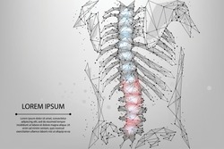 Abstract mesh line and dot physiotherapy human spine. Low poly Pain area surgery operation. Polygonal render back hernia vector illustration