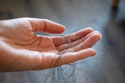 Hair loss concept. Young woman holding a lot of fallen hair in her hands.