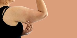 A young Asian woman grabbing skin on her upper arm with excess fat isolated on a white background. Pinching the loose and saggy muscles. Overweight concept