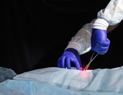 A doctor spinal surgeon with a medical instrument in his hands performs an operation to eliminate spinal scoliosis in a patient. Vertebral implantation