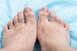 Hairiness on the toes of a person, macro. Hygiene and cosmetology concept, hair removal