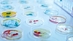 Microbiology Laboratory: Petri Dishes with Various Bacteria Samples, Pipette Drops Liquid Solution. Concept of Pharmaceutical Research of Antibiotics, Curing Disease Fighting Epidemics. Close-up Macro